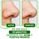 Mascarilla facial Lanbena + 60 tiras