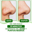 Lanbena®: Mascarilla avanzada para puntos negros